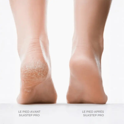 Têtes de rouleau lavables pour lime à pieds électrique.